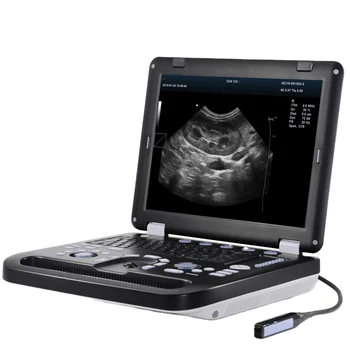 BT-UD63 80 de elemente, ,3D/4D, ecografie doppler color scanner medical instrumente cu ultrasunete portabil cu ultrasunete 3d mașină